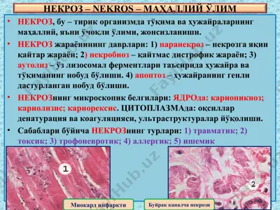 nekroz — PPT