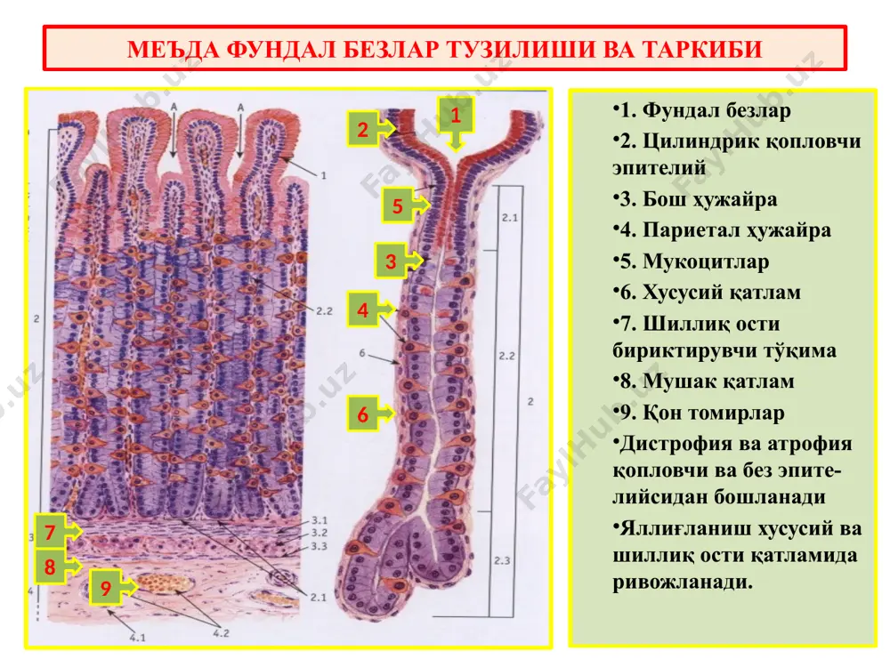 лорик безларга айланган. хусусий қатлам диффуз яллиғланиш инфильтрати билан қопланган. сурункали атрофик гастрит фундал безлар тўлиқ қайта тузилган юза қопловчи ҳамда без эпителийси орасида қадоҳсимон ҳужайралар пайдо бўлган. метаплазия ва энтерализация ривожланган хусусий қаватда лимфоид фолликула пайдо бўлган сурункали атрофик гастрит яра касаллиги яра касаллиги, бу – сурункали циклли кечувчи касаллик бўлиб, асосий клиник-морфологик белгиси меъда ёки 12 б.и да рецидивланадиган яра пайдо бўладиган касалликдир. этиология ва патогенези: 1) helicobacter pilory (австралиялик патологоанатом робин уоррен топган ва 2005 йил нобел мукофотини олган); 2) нпвс – нестероидные противовоспалительные средства – яллиғланишга қарши ностероид моддалар; 3) руҳий толиқишлар ва зўриқишлар. патогенези: 1) умумий; 2) маҳаллий омиллар. маҳаллий – нейро-гуморал бузилишлардан кислота-пептик омил, шиллиқ парда тўсиғи, моторикаси бузилиб морфологик ўзгаришлар пайдо бўлади. умумий – нейроген зўриқиш ва толиқишлар оқибатида бош мия пўстлоғи бошқаруви бузилиб, оралиқ мия ва гипоталамусга таъсир кўрсатади, натижада адашган нерв қўзғалиб, тонуси ошади, натижада кистола-пептик омил фаоллашади, моторика кучаяди. яра …