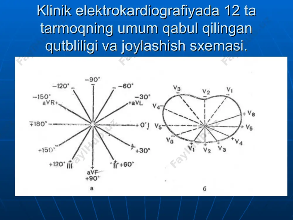 rakt; 5— atreoventrikulyar bog’lanish; 6—giss ustuni;7-giss tutamining o’ng oyoqchasi; 8—giss tutami chap oyoqchasining oldingi tarmog’i 9—giss tutami chap oyoqchasining orqa tarmog’i. 10— purkine tolalari. 11—o’ng kent tutami. 12—chap kent tutami. av-blokada i daraja. p-q(r) intervalining davomiyligi 0,2 s dan oshishi. av-blokada ii daraja, mobits 1. qrst qorinchalar kompleksini pasayishi bilan p-q intervalini asta-sekin uzayishi. av-blokada ii daraja, mobits 2. pq intervalining uzayishisiz qrst qorinchalar kompleksini pasayishi. to’liq av-blokada. bo’lmacha (р) va qorinchalar (qrst) ritmining to’liq ajralishi hamda qorinchalar qisqarish sonini kamayishi. minutiga 60—30 gacha yoki undan kamroq. giss tutami o’ng oyoqchasining to’liq blokadasi. giss tutami o’ng oyoqchasining to’liq blokadasi. 1) o’ng ko’krak tarmoqlarida v1,2 (iii va avf qo’l oyoq tarmoqlarida kamroq) qrst kompleksi rsr yoki rsr‘ m-simon bo’ladi. sabab r1 > r; 2) chap ko’krak tarmoqlarida (v5,v6), i, avl tarmoqlarda ko’p uchraydigan kengaygan o’tmas s tish. 3) qrs kompleksining davomiyligi 0,12 s dan oshgan. 4) v1 tarmoqda (iii tarmoqda kam …