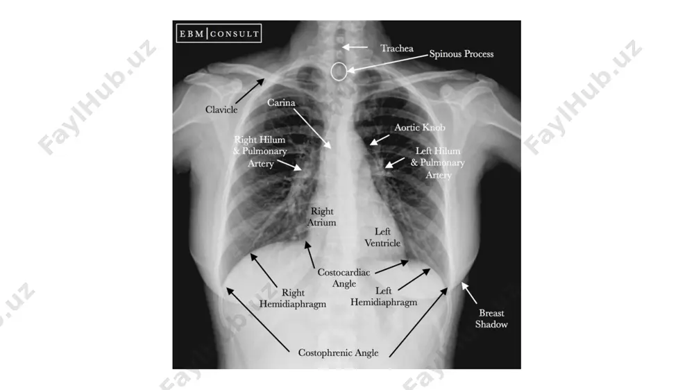 lung - Page 2