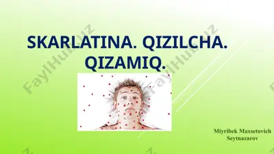 skarlatina, qizilcha, qizamiq — PPTX