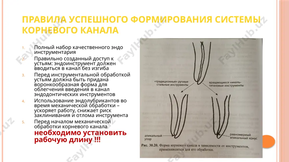 основной источник инфекции находится в корневом канале, а не в околоверхушечных тканях. об этом говоится в экспериментальной работе e. w. fish (1939), в которой теоретически обосновывается тактика эндодонтического лечения и необходимость использования антимикробных средств для дезинфекции корневого канала зоны защитной реакции зубов с хроническим периапикальным поражением в ответ на некроз пульпы 1. зона инфекции. в ней находят микроорганизмы, некротизированные ткани и большое количество полиморфно-ядерных лейкоцитов. это центральная зона, или зона корневого канала зоны защитной реакции зубов с хроническим периапикальным поражением в ответ на некроз пульпы 2. зона контаминации. не содержит микроорганизмы, но сильно инфильтрирована круглыми клетками и полиморфно-ядерными лейкоцитами. вследствие раздражения токсинами, диффундирующими из зоны инфекции, в этой зоне накапливаются погибшие остеоциты. зоны защитной реакции зубов с хроническим периапикальным поражением в ответ на некроз пульпы 3. зона раздражения. здесь токсины, проникающие из зоны инфекции и проходящие через зону контаминации, настолько «разбавлены», что оставляют в живых гистиоциты и остеокласты, которые разрушают …