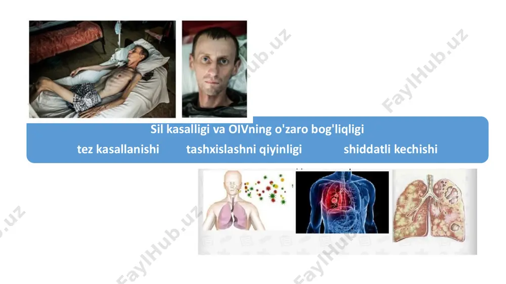 sil va oitsning birgalikda kechishi, klinikasi, diagnostikasi, prognozi - Page 3