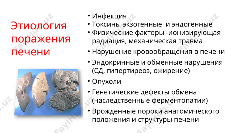 мощью печеночных проб большая пкн –значительные метаболические и клинические проявления (печеночная энцефалопатия и геморрагический синдром) малая печеночная недостаточность сопровождает все заболевания печени лабораторные признаки синдрома пкн холинэстеразы в плазме крови протромбина в сыворотке крови гипоальбуминемия и гипопротеинемия аст, алт 5 и 7 факторов свертывания крови холестерина билирубина (за счет свободного билирубина) в крови печеночно-специфических ферментов (орнитин-карбамоилтрансферазы, фруктозо-1-фосфатальдолазы,сорбитдегидрогеназы) синдром цитолиза механизмы: повышение проницаемости мембран гепатоцитов некроз гепатоцитов и его органелл лабораторные маркеры синдрома цитолиза алт,аст, ггтп, лдг, билирубина появление печеночно-специфических ферментов (фруктозо-1фосфат-альдолаза, 5-нуклеотидаза, сорбитдегидрогеназа, в-глюкуронидаза) концентрации сывороточного железа, витамина b12 в крови резкое падение активности печеночно-специфических ферментов на фоне ухудшения общего состояния больного - признак тотальной гибели гепатоцитов фармакологическая коррекция заболеваний печени 1. средства, влияющие на процессы тканевого обмена 2. средства, восстанавливающие дезинтоксикационную функцию печени 3. желчегонные средства 4. противовирусные и антимикробные средства 5. иммуномодуляторы 6. противовоспалительные средства (стероидные и нестероидные) 7. гепатопротекторы 8. антиоксиданты препараты для лечения заболеваний печени гепатопротекторы …