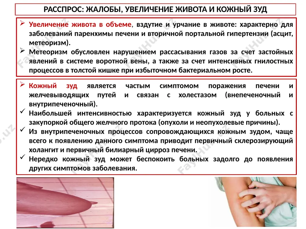 ых и прочих веществ (инъекции), отношение пациента к группам риска (наркоманы, сексуальные меньшинства), контакт с ядовитыми веществами. осмотр пациентов с заболеваниями печени и жвп общий осмотр, 1 нарушения сознания при печеночной коме (интоксикация метаболитами белков: аммиак, фенол, ароматические и серосодержащие аминокислоты). положение больного: активное – при легких формах гепатита, хронический холецистит пассивное- печеночная кома вынужденное- печеночная колика 3. изменение массы тела. 10 осмотр пациентов с заболеваниями печени и жвп общий осмотр, 2 изменение кожных покровов – желтуха, обусловленная гипербилирубинемией: паренхиматозная. гемолитическая. механическая. печеночные знаки (при увеличении эстрогенов и бав, не утилизирующихся в печени: сосудистые звездочки – телеангиоэктазии, располагающиеся преимущественно на верхней половине туловища. печеночные ладони – эритема thenar и hypothenar. снижение оволосения (у мужчин – по женскому типу) гинекомастия. геморрагии синячкового типа, обусловленные нарушением свертываемости крови из-за печеночной недостаточности и снижения витамина к, протромбина, фибриногена и т.д.). гипопротеинемические отеки при снижении белково-синтетической функции печени. осмотр пациентов с заболеваниями печени и …