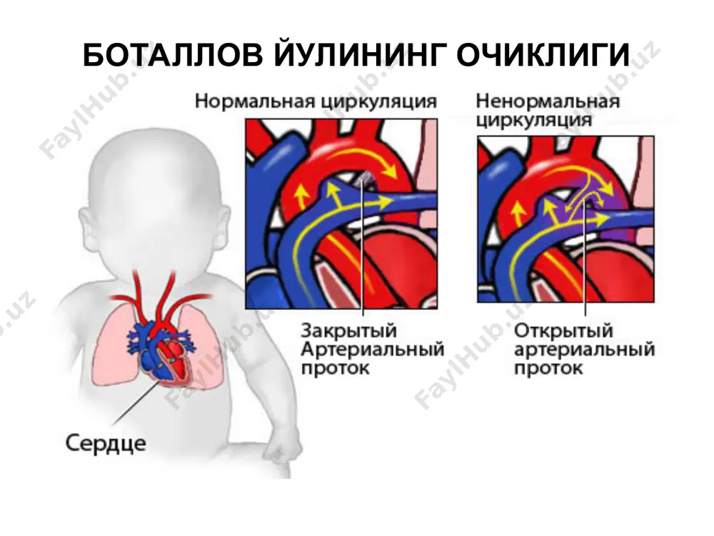 баталлов йулини очик колиши - Page 5