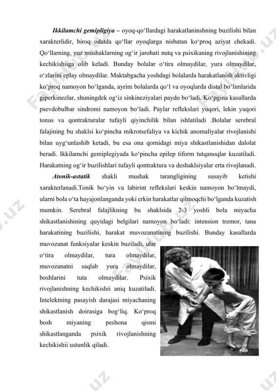 g kechikishii odatda dizartriya alaliyaning turli shakllari bilan uyg‘unlashib ketadi. serebral falaj bolalarda ko‘pincha psevdobulbar dizartriya kuzatiladi. dizartriyaning bu shakli uchun nutq muskulaturasi tonusining ko‘tarilishi xosdir. bunda og‘iz bo‘shlig‘idagi til taranglashadi, uning orqasi spastik egilgan uchi aniq emas. lablar spatik taranglashib, mushak tonusining ko‘tarilishi bo‘lib artikulyatsion apparat ayrim mushak gruppalaridagi gipotoniya va distoniya bilan almashinib turishi mumkin. artikulyatsion mushaklar parezi psevdobulbar dizartriya tipidagi ovoz chiqarishining buzilishini keltirib chiqaradi. ovoz hosil qilish va nafas buzilishi xarakterlidir. ko‘pincha artikulyatsion muskulaturada hamoxang harakatlar (sinkneziyalar) kuzatiladi. serebral falaj bo‘lgan bolalarda nutq buzilishlari kamdan-kam hollarda alohida uchraydi. ko‘pincha dizartriyada nutq rivojlanishi kechikishii yoki alaliya birga uchraydi. sensor buzilishlar – bolalar serebral falajligida (ayniqsa giperkinetik shaklda) ko‘pincha eshitish qobiliyati pasayadi (odatda yuqori chastotali tonlarda kuzatiladi). bu esa, dizartriyaning bo‘lmasligiga, bir qator tovushlarni hosil qilishning buzilishiga olib kelishi mumkin. yuqori chastotali tovushlarni (t, k, s,p, e, f, sh) eshitmaydigan bola, ularni nutqida ishlatmaydi. kelgusida bunday bolalarni o‘qish …