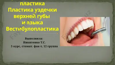 мукогингивальная пластика — PPT