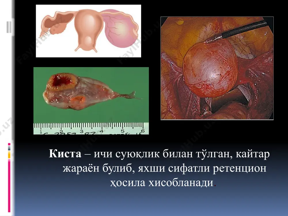 zoq dagi ichki azolarga (oshqozon, ichak, charvi, jigar) metastazlar, kaxeksiya ro'y bergan. xulosa e'tiboringiz va sabringiz uchun raxmat image2.jpeg image3.jpeg image4.jpeg image5.jpeg image6.png image7.jpeg image8.jpeg image9.png image10.png image11.jpeg image12.jpeg image13.jpeg image14.png image15.jpeg image16.png image17.jpeg image18.png image19.jpeg image20.png image21.png image22.png image23.png image24.png image25.jpeg image26.jpeg image27.png image28.jpeg image29.png image30.jpeg image31.png image32.jpeg image33.png image34.png image35.jpeg image36.png image37.png image38.jpeg image39.jpeg image40.jpeg image41.jpeg image42.jpeg image43.jpeg image44.png image45.jpeg image46.jpeg image47.jpeg image48.png image49.png image50.png image51.png image52.png image53.png image54.png image55.png image56.png