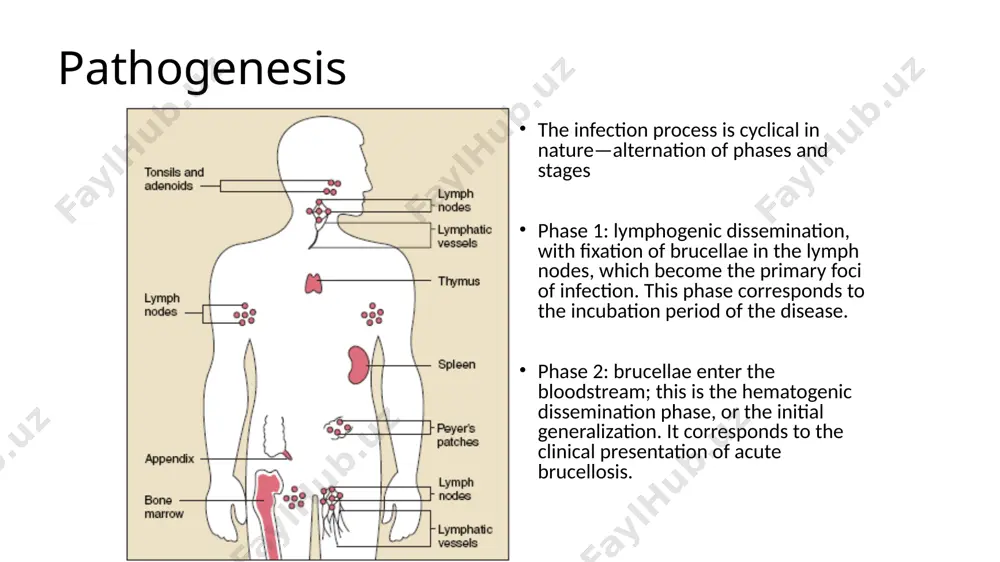 g up to 3 months: a. by completeness of clinical symptoms: - acute septic form; - septic-metastatic form. 3. sub-acute brucellosis lasting from 3 to 6 months. 4. chronic brucellosis lasting from 6 months to 2 years. 5. primary chronic brucellosis. 6. residual brucellosis (clinical presentation of sequelae of brucellosis history). by site of foci of infection in sub-acute and chronic brucellosis: - osteoarticular form neural form urogenital form visceral form combined form (combined damage to organs). depending on the degree of incapacitation, subacute and chronic brucellosis are divided into: - compensation phase (corresponds to the remission period without clinical signs of the disease); subcompensation phase (clinical presentation leading to reduced capacity); decompensation phase (most pronounced clinical presentation leading to incapacitation). clinical criteria 1. general infection syndrome: - relatively long satisfactorily tolerated fever; - chills of varying severity; - increased sweating; - overall weakness and malaise. 2. symptoms of focal …