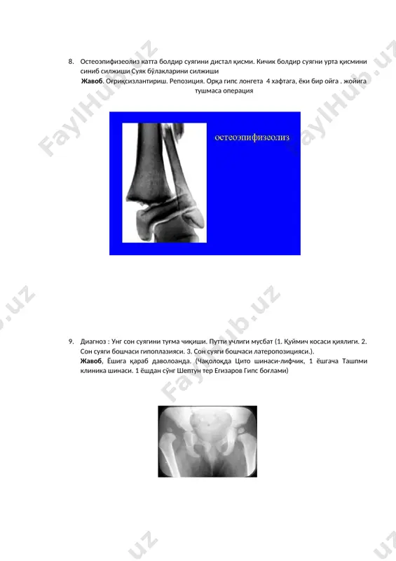 uvrov suyagini urta kismidan sini... - Page 5