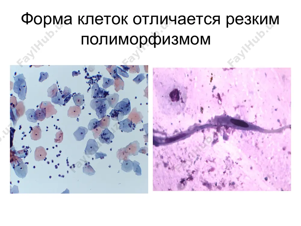 определение злокачественности клеточных элементов - Page 4