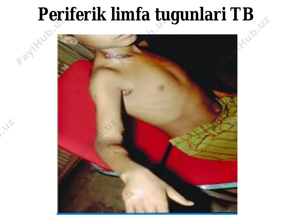 periferik limfa tugunlari sili - Page 4