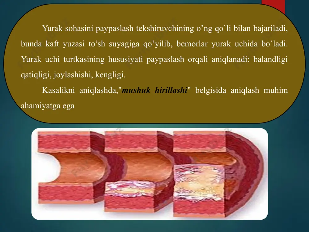 leykotsitar formula. toj tomirlar arterosklerozi. - Page 5