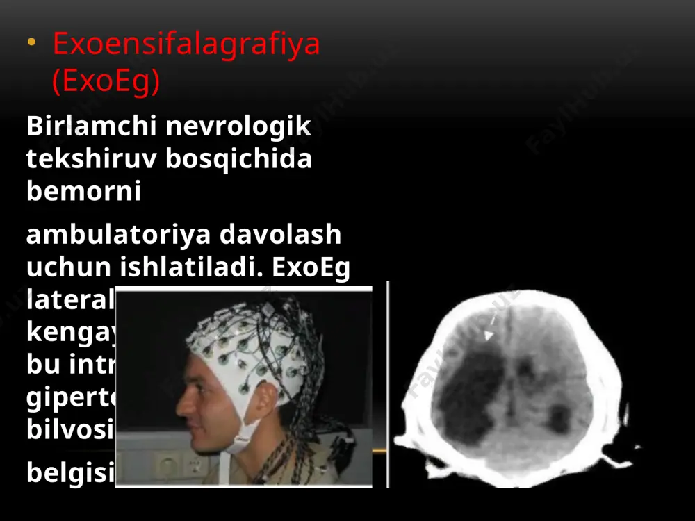 kalla-suyagi, bosh miya nur tekshiruv usullari. markaziy nerv tizimi kasalliklari - Page 4