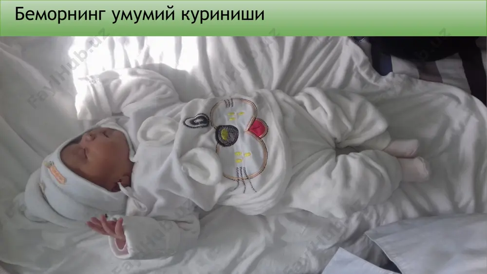 amnezlarga asoslanib kuyidagicha tashxis kuyildi: chakaloklar kechki neonatal davr pnevmoniyasi. tekshiruv rejasi umumiy qon analizi siydik analizi axlat analizi ,bioximik kon taxlillari (oksil) kukrak kafasi rentgenogrammasi kursatkichi yoshi natija norma kattalarniki gemoglobin g/l 90 180-240 120-140 eritrotsiti x1012/l 3,4 5,5< 4,2-5,5 kon ivish vakti - 4-5 min rang ko'rsatkich 0,8 0,8-1,05 trombotsiti x10 9/l - 180-320 180-320 soe mm /ch 8 2-10 4-15 leykotsiti x109/l 8,7 4-9 leykotsitarnaya formula neytrofil palochkoyader % - 1-6 1-6 neytrofil segmentoyad % - 42-72 42-72 eozinofili % - 1-5 1-5 bazofili % - 0-1 0-1 limfotsiti % - 10-37 10-37 monotsiti % - 3-10 3-10 siydik taxlili rangi – somon sariq oqsil – abc reaktsiyasi(ph) – kislotali eritrotsit- 1-2 epiteliy- 4-5ta shilliq - yuk leykotsit- 1-2 umumiy axlat analizi konsistentsiyasi- suyuk rangi - sarik shillik + neytrofillar - yog kislotalari + yodafil xujayralar + leykotsitlar – 9-10 kuruv maydonida bioximik kon taxlili oksil 30 …