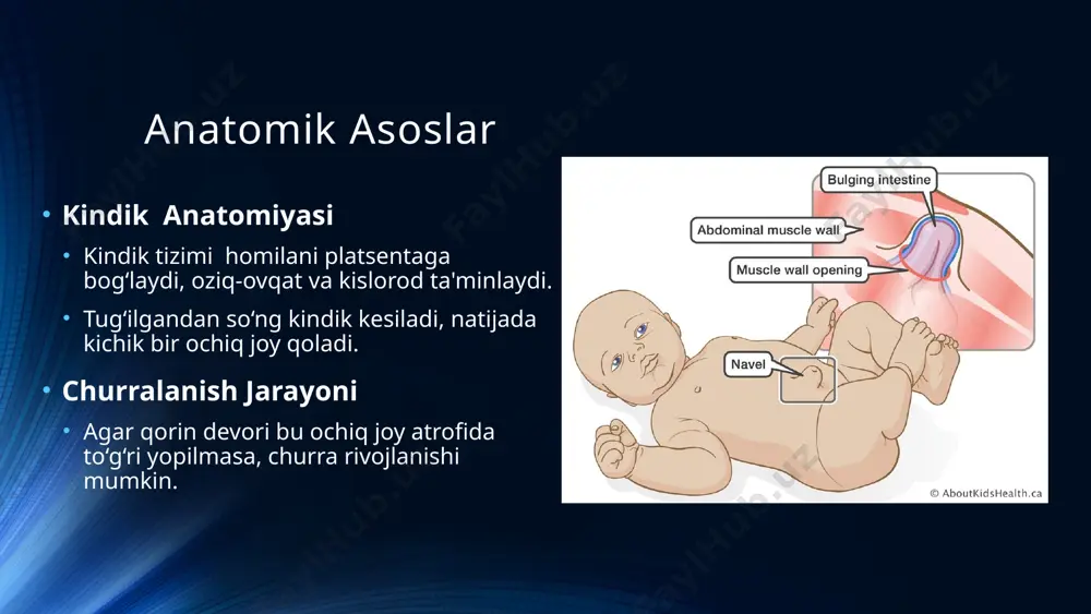 umbilical hernia in children - Page 3