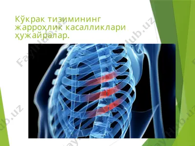 kўkraq tizimining jarrohlik kasalliklari hujayralar — PPTX