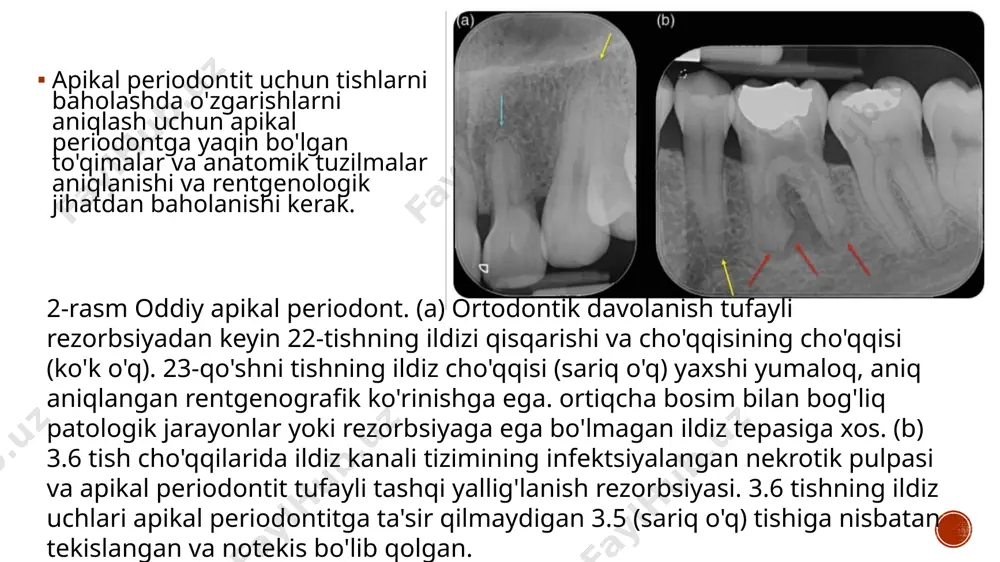 zamonaviy rentgen tashxislash usullari - Page 4