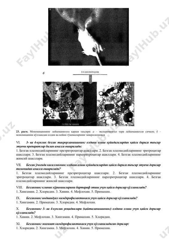 лари. 4. безгак плазмодийсининг жинсий шакллари. 23. расм. мономициннинг лейшманиозга қарши таъсири: а – экспериментал тери лейшманиозли сичқон; б – мономицинни қўллашдан олдин ва кейин тўқималарнинг микроскопияси vi. 3- ва 4-кунлик безгак такрорланишининг олдини олиш қуйидагилардан қайси бирига таъсир этувчи препаратлар билан амалга оширилади: 1. безгак плазмодийларининг преэритроцитар шакллари. 2. безгак плазмодийларининг эритроцитар шакллари. 3. безгак плазмодийларининг параэритроцитар шакллари. 4. безгак плазмодийларининг жинсий шакллари. vii. безгак ўчоғида касалликнинг олдини олиш қуйидагилардан қайси бирига таъсир этувчи дорилар томонидан амалга оширилади? 1. безгак плазмодийларининг преэритроцитар шакллари. 2. безгак плазмодийларининг эритроцитар шакллари. 3. безгак плазмодийларининг параэритроцитар шакллари. 4. безгак плазмодийларининг жинсий шакллари. viii. безгакнинг клиник кўринишларини бартараф этиш учун қайси дорилар қўлланилади? 1. хингамин. 2. хлоридин. 3. хинин. 4. мефлохин. 5. примахин. ix. безгакнинг индивидуал кимёпрофилактикаси учун қайси дорилар қўлланилади? 1. хингамин. 2. примахин. 3. хлоридин. 4. мефлохин. x. безгакнинг 3- ва 4-кунлик рецидивлари (қайталанишининг) олдини олиш учун қайси дорилар қўлланилади? 1. хинин. …