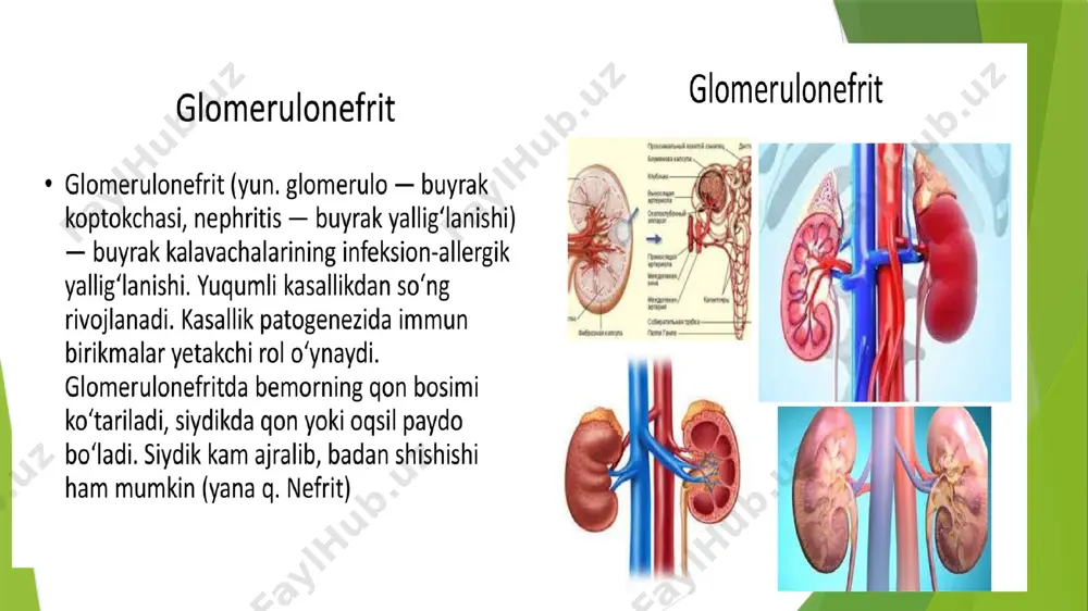 glomerulonefrit - Page 2