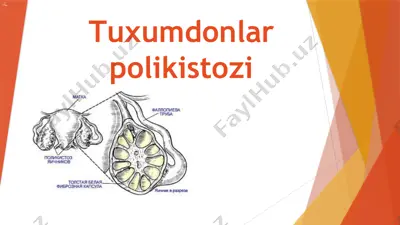 tuxumdonlar polikistozi — PPTX