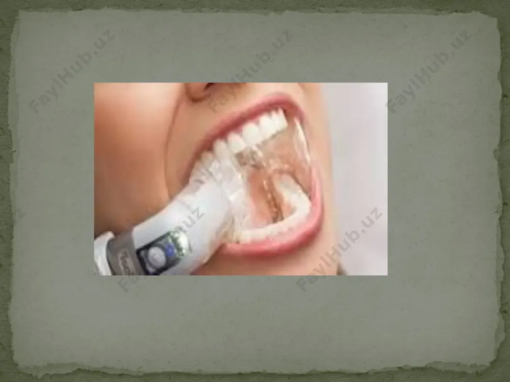 lari och sargish rangi---- shafofligi tufayli u asosan endodontik davolashda qullaniladi.kompozitlar bilan ishlashda uni ishlatish muvofiq emas yashil---- yuqorida sanab utilgan och,tuq va yashil ranglarga alternativa sifatida kuk,och,kuk pushti, nastarin rangli koferdam rangi shtamp (marker) - bu tishning holatiga mos keladigan lateksda belgilar yaratish uchun siyohni o'z ichiga olgan asbob. ba'zi hollarda (masalan, yupqa peçete) siz kesuvchi tishlarga elastik salfetkani qo'yishingiz va ularni sharikli qalam yoki flomaster bilan chegaralashingiz mumkin. punch (zarba) tishning bo'yinining parametrlariga muvofiq kauchukda teshiklarni yaratishga yordam beradi. 0,5 dan 2,5 mm gacha bo'lgan har xil uzunlikdagi kesishlarni amalga oshiradigan turli zımbalar mavjud. paketga qanday aksessuarlar va asboblar kiritilgan: optidani -ushlab turadigan shtapellarni to'g'ri joylashtirish va olib tashlash uchun ushlagichlar va kliplar kerak. ba'zan shtapellar tushib ketmasligi uchun kliplarni sozlash kerak. ular o'zgartirilishi va boshqa shaklga keltirilishi mumkin bo'lgan chuqurchaga ega. yog ', ortiqcha oro bermay va iplar.- ushbu aksessuarlar tishlar orasidagi lateksning cho'zilishini engillashtirish uchun kerak. …