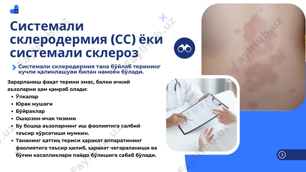 ювенил склеродермия - Page 5