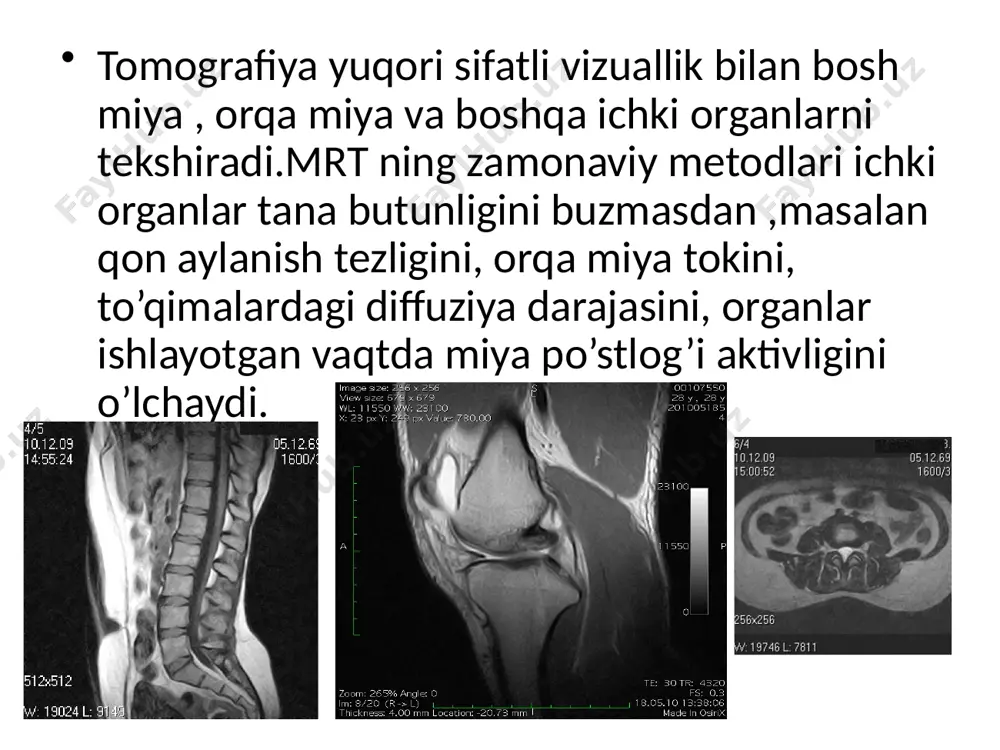 magnit-rezonans tomografiya - Page 3