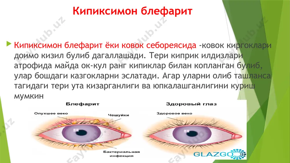 ko'z sohasi kasalliklar - Page 4