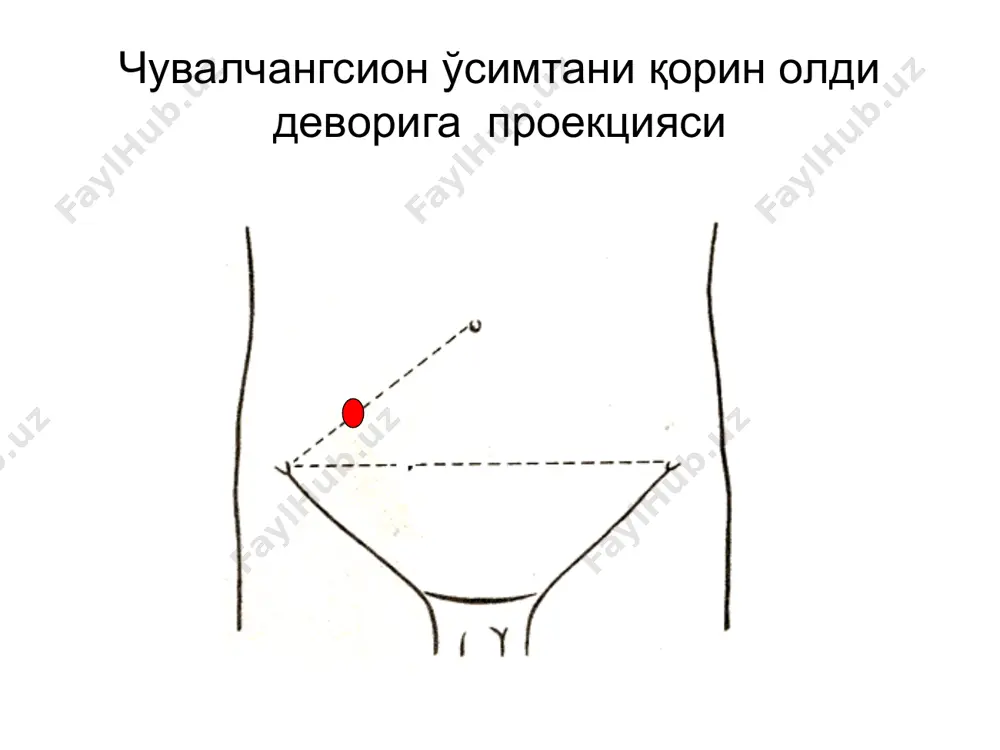 ак») – кўйлак устидан сирпанувчи ҳаракат қилганда ўнг ёнбош соҳада оғриқни кучайиши ровзинг – чап ёнбош соҳада перкуссия қилганда ўнг ёнбош соҳада оғриқнинг кучайиши раздольский – ўнг ёнбош соҳани перкуссиясида шу соҳада оғриқ бўлиши ситковский – чалқанча ётган ҳолатдан чап ёнбошга бурилаганда, ўнг ёнбош соҳада оғриқни кучайиши бартомье-михельсон – бемор чап ёнбошда ётганда, ўнг ёнбош соҳани пальпацияси оғриққа олиб келади кохер-волкович – оғриқни эпигастрийдан ўнг ёнбош соҳага кўчиши ўткир аппендицитни умумий симптомлари оғиз қуриши ва тилни оқ караш билан қопланиши тахикардия субфебрил температура эчт ошиши лейкоцитоз лейкофорулани чапга силжиши билан қорин бўшлиғини ультратовушли текшируви қорин бўшлиғидаги эркин суюқлик диагностик лапароскопия тўғридан – тўғри қорин бўшлиғидаги патологик жараённи, шу жумладан ўткир аппендицитни, аниқлашга ёрда берадиган усул дьяконов-волкович бўйича кесма кесмани босқичлари апоневрозни кесиш мускулларни очиш қорин пардани кесиш операция босқичлари кўр ичак губазини чиқазиш чувалчангсимон ўсимтани жароҳатга чиқазиш чувалчангсимон ўсимта тутқичини боғлаш операция босқичлари кисет чокини қўйиш аппендэктомия ўсимта чўлтоғини чўктириш …