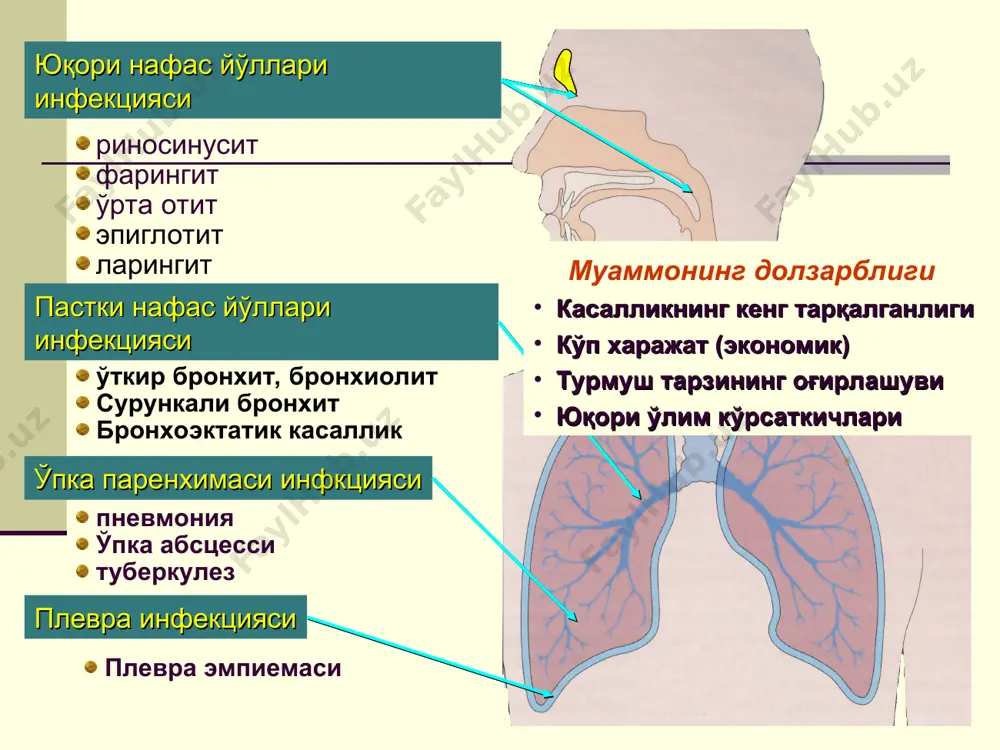 ифи келиб чиқиши бўйича: уй пневмонияси касалхона пневмонияси перинатал иммунитет танқислигидаги пневмония морфологик кўриниши бўйича: ўчоқли сегментар ўчоқлар қўшилиши крупоз интерстициал кечиши бўйича: ўткир чўзилган асоратлар бўлишига қараб: асоратланмаган асоратланган (токсикоз, инфекцион –токсик карахтлик, синпневмоник плеврит, метапневмоник плеврит, катталар туридаги респиратор дистресс синдром, ўпка деструкцияси, двс-синдром пневмониянинг умумий белгилари нафас олишда ёрдамчи мушакларнинг иштирок этиши (обструкциясиз) хансираш: - 2 ойгача бўлган болаларда минутига 60 тадан ортиқ; - 2 ойдан 1 ёшгача бўлган болаларда 50 дан ортиқ; - 1 ёшдан катта болаларда 40 дан ортиқ. тана ҳароратининг 3 кундан ортиқ 38,5 с дан катта бўлиши; тахикардия, тери рангининг оқариши, иштахасизлик; кўкрак қафаси рентгенограммасида ўчоқли ёки сегментар характерли инфильтратив ўзгаришларнинг мавжудлиги ўткир пневмонияни клиник ташҳислаш алгоритми кўрув бошланиши т°>38°>3 кун ва/ёки ҳансираш ва/ёки қовурғалар оралиғи нинг тортилиши (обструкциясиз) локал белгилар перкутор товуш нинг қисқариши ва/ёки сустлашган ёки бронхиал нафас ва/ёки локал хириллаш лар нам хириллаш- ларнинг асиммет- риклиги токсикоз белгилари кўкрак қафасини …