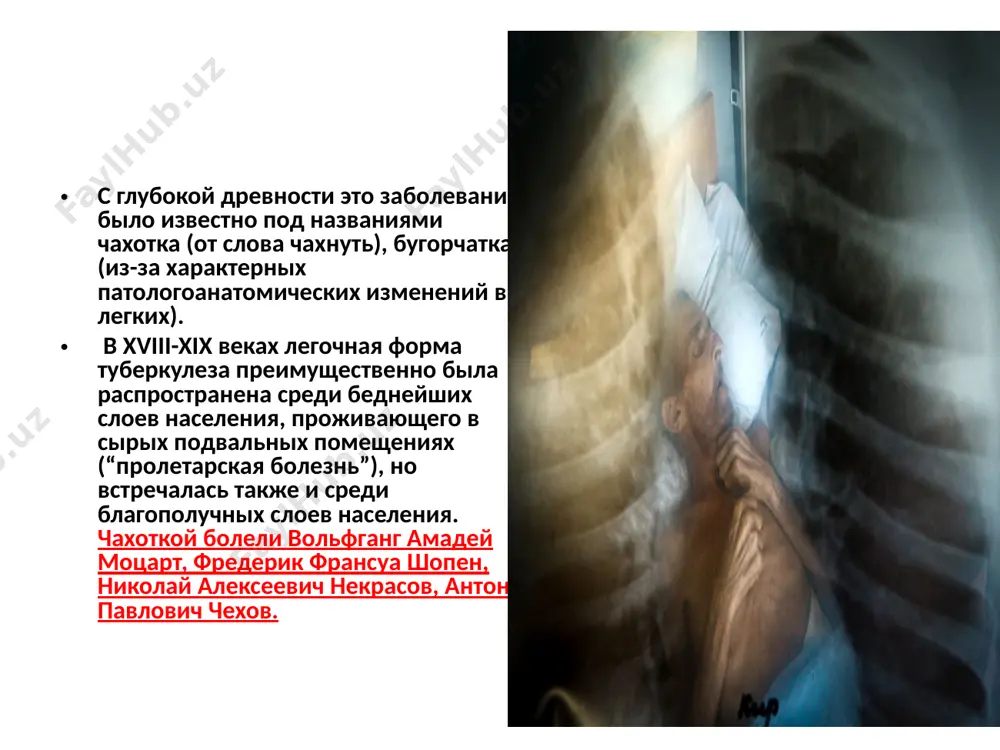 драсположенность (hla- комплекс содержит локусы ответственные за развитие туберкулеза. если эти локусы повреждены, индивид заболеет туберкулезом. если изменений локусов нет- степень заболевания туберкулезом не высока) о мерах по совершенствованию системы оказания специализированной фтизиатрической и пульмонологической помощи: проведение комплексной профилактики туберкулеза и неспецифических заболеваний легких на основе внедрения инновационных методов, организацию диагностики и лечения латентных форм туберкулеза, лиц, подверженных повышенному риску заражения туберкулезом, а также контактирующих с больными лекарственно-устойчивым туберкулезом; в срок до 1 апреля 2019 года определить обоснованный контингент лиц, подверженных повышенному риску заражения туберкулезом, в целях проведения иммунодиагностики; число тв инфицированных на земном шаре проживает – 7 млрд людей 2,3 млрд из них инфицированы микобактериями, 10% из них заболеют различнми формами туберкулеза. во всем мире ежедневно от туберкулеза погибают около 5000 человек – если бы их выявили чуть раньше, многим можно было бы сохранить жизнь 27 27 3 the global burden of tuberculosis is truly enormous with some 1.9 …
