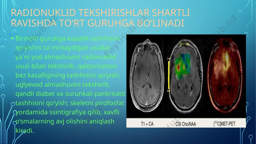 i davolashdan oldin va keyin faoliyatining buzilganlik darajasini aniklash kiradi. bu' usulda asosan radiografiya qo‘llaniladi. eetibo e'tiboringiz uchun rahmat image1.png image3.png image4.jpeg image5.jpeg image6.jpeg image7.jpeg image8.gif image9.gif image10.gif image11.jpeg image12.gif image13.jpeg image14.jpeg image15.jpeg image16.jpeg image17.jpeg image18.jpeg image19.jpeg image20.jpeg image21.jpeg image22.jpeg