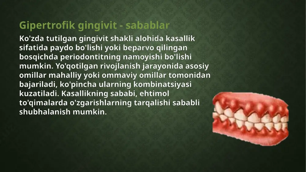 giperplastik gingivit - Page 4