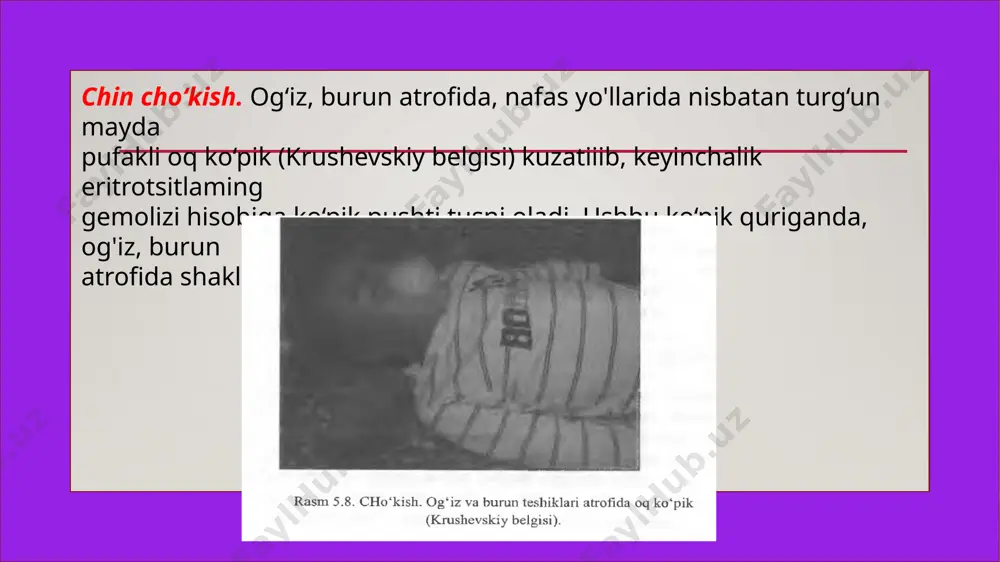 cho'kish holatlari va ularning muddati - Page 5