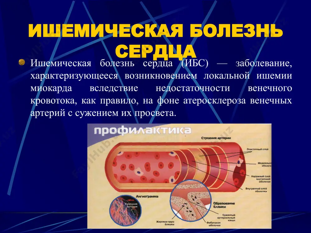 ь общий риск сердечно-сосудистых событий, например с помощью расчётных диаграмм (например, шкалы score). оценивая риск развития ссз, следует учитывать все имеющиеся у данного пациента факторы риска. даже если уровень каждого из них повышен умеренно, риск развития ссз может быть высоким из-за их суммирования. скрининг с проведением нагрузочных проб рекомендован при высоком риске коронарного атеросклероза, а также при обследовании пациентов с сд без клинических симптомов ибс. следует информировать пациентов с высоким риском сердечно-сосудистых событий о возможных проявлениях ибс и её последствиях, обсуждать целесообразность мероприятий по выявлению ишемии миокарда. у пациента с высоким риском сердечно-сосудистых событий целесообразно провести мероприятия по диагностике ишемии миокарда. группы скрининга скрининг на ибс в группах лиц, работа которых связана с возможной опасностью для жизни других людей (водители автомобильного и железнодорожного транспорта, пилоты, диспетчеры и другие профессии), определяется существующими приказами и инструкциями. не рекомендовано проводить рутинный скрининг эпизодов ишемии миокарда (с помощью экг в покое, пробы с физической …