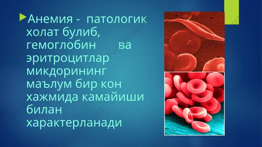 ак трактида секрециясини пасайиши. одам дармонсизланади, жисмоний жиҳатдан салга чарчаб қолади, харакат қилганда ҳансирайди, боши айланади, қулоғи шанғиллайди. тирноқларида трофик ўзгаришлар бошланиб узунасига ёки кўндалангига кетган чизиқчалар юзага келиб, тирноқ қошиқсимон бўлиб қолади. диагностикаси. тери ва шиллик пардалар рангпар юрак нисбий чегарасининг бироз чапга силжиши юрак чуккисида юмшок систолик шовкин лакланган тил: шиллик кават атрофияси, огиз бурчаклари бичилиши, ангуляр стоматит каттик овкатни ютиш кийинлиги (бехтерев синдроми) ошкозон шиллик кавати атрофияси, ахилия инфантилизм. лабаротория кўрсаткичлари labaratoriya ko’rsatkichlari normal (birinchi erkaklarda, ikkinchi erkaklarda) temir tanqisligi kamqonligida eritrotsitlar soni gemoglabin miqdori rang ko’rsatkichi gematokrit qon zardobidagi temir miqdori temirga to’yinish 4-50*10 12/l 3.9-4,7*10 12/l 130-160 g 120-140 g 0,8-1,01 40-48% 36-42% 12,5-30,14 mkmol /l 17-54% o’zgarmaydi yoki kamayadi kamayadi kamayadi kamayadi kamayadi kamayadi даволаш. анемия сабабини даволаш пархез : оксиллар-140-150 г/сут, ёглар-70-80 г/сут, витамин с 1 даража анемияда- темир препаратлари per os: мальтофер, феррум-лек, тардиферон 2 даража анемияда- темир препаратлари м/и, в/и мальтофер, …