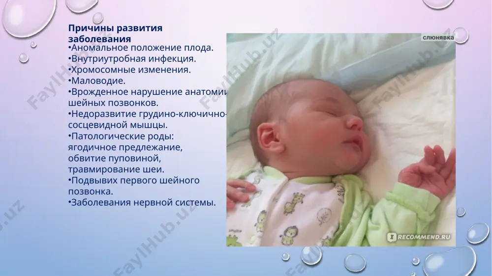 о делать ребенку при кривошее? при этой патологии рекомендуются удлинённые курсы, состоящие из 12–15 сеансов. курсы повторяются каждые 2–3 месяца до полной компенсации, а затем ещё дважды в год в качестве поддерживающей меры. такая продолжительность связана с тем, что спазмированная мышца с трудом меняет свою форму и нужно много раз ею заниматься, чтобы она «запомнила» нормальное положение. как уложить ребенка спать при кривошее? нужно класть младенца на сторону, противоположную патологии. для этого необходимо развернуть кроватку так, чтобы малыш мог обозревать большую часть комнаты. хорошо повесить яркие игрушки, которые бы привлекали внимание и заставляли ребенка поворачивать голову так, чтобы кривошея постепенно компенсировалась. image2.png image4.jpeg image3.png image5.jpeg image6.jpeg image7.jpeg image8.jpeg image9.jpeg image10.jpeg image11.jpeg image12.jpeg image13.jpeg image14.jpeg image15.jpeg image1.png /docprops/thumbnail.jpeg