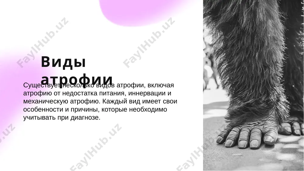 атрофия и ее виды - Page 4