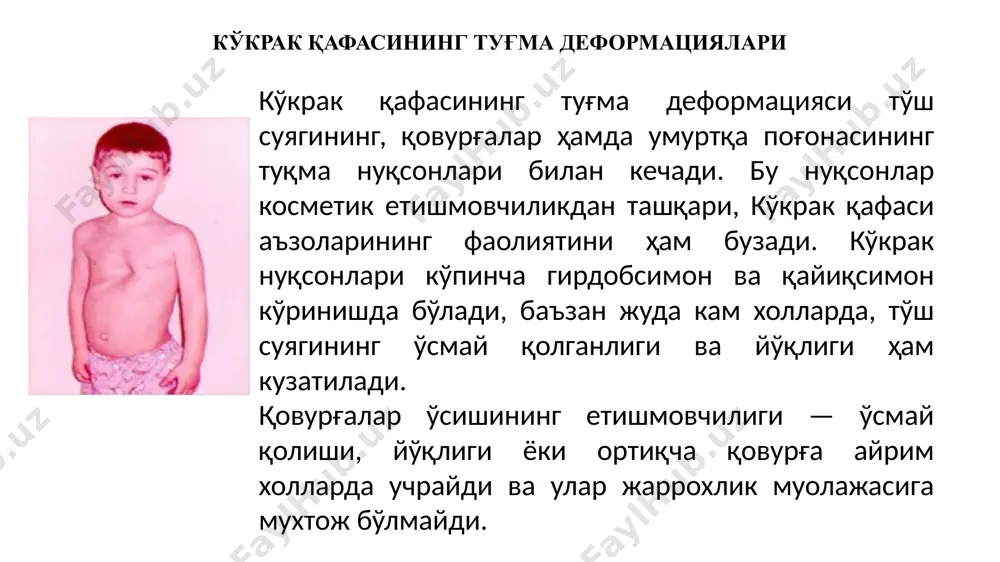 arajasi ko'p bo'lmagan chuqurlik (2 sm gacha) va ko'krak qafasi a'zolarining ish faoliyati buzilmasligi bilan ifodalanadi. ikkinchi darajasida chuqurlik ancha ko'p, ko'krak qafasi a'zolarining ish faoliyati buzilishi (tez charchash, nafas etishmovchiligi, yurakning tez urishi, o'yin yoki og'ir mexnat paytlarida), tez-tez yuqori nafas yo'llarining yallig'lanishi, pnevmoniya kuzatiladi. uchinchi darajada deformatsiya aniqroq qomatning buzilishi bilan ko'krak qafasi, ba'zida umurtqa pogonasining yon tomonga qiyshayishi, ko'krak qafasining nafas olishida ham ishtirok etishi va ko'krak a'zolari vazifasining buzilishi aniq, bo'lib, tashqi nafasning izdan chiqishi, yurak etishmovchiligi bilan ifodalanadi. ko'krak qafasining deformatsiyasi emizikli bolalarda ham kuzatilishi mumkin. uning boshlangich belgilari nafas olish paradoksi, nafas olganda to'sh va qovurg'alarning cho'kishi xisoblanadi. bu yoshdagi bolalarda yuqori nafas yo'llarining qizarishi va zotiljam kasalligiga moyillik bo'ladi. bolaning yoshi kattalashishi bilan deyarli 50 foizida deformatsiya ko'payadi va to'sh qovurg'alarning cho'kishi kuzatiladi. bog'cha va maktabgacha bo'lgan yoshda deformatsiya aniq, tus oladi, bolaning ko'rinishi va qomati o'zgaradi, ko'krak kifozi kuchayadi. girdobsimon ko'krak qafasining …