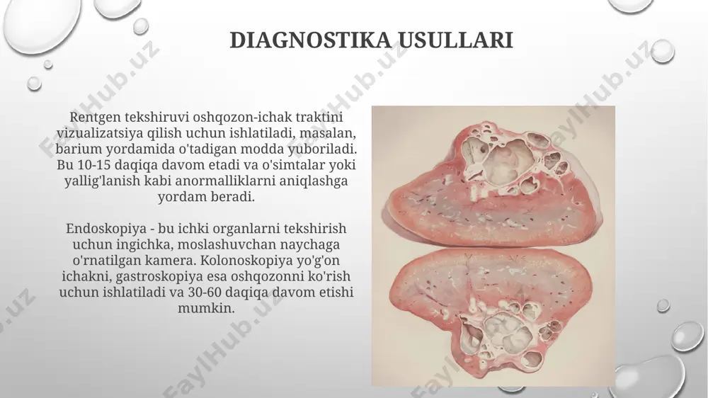 ufagida xolesterin, bilirubin va kaltsiy tuzlaridan iborat toshlar hosil bo'lishi bilan xarakterlanadi. xolesistit, o't pufagining yallig'lanishi, ko'pincha o't toshlari (90-95% hollarda) yoki bakterial infeksiya sabab bo'ladi. o'ng qovurg'a ostida qattiq og'riq va isitma bilan kechadi. e'tiboringiz uchun rahmat @taqdimot_robot image3.png image4.jpg image5.jpg image6.jpg image7.jpg image8.jpg image9.jpg image10.jpg image11.jpg image12.jpg image13.jpg image14.jpg image15.jpg image16.jpg image17.jpg image18.jpg image1.png