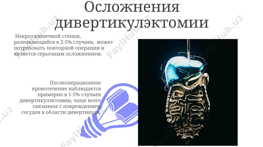 , obespechivaya nadejnoe udalenie patologicheskogo obrazovaniya i predotvrashaya retsidivi. primenenie endoskopicheskix metodov, takix kak laparoskopicheskaya divertikulektomiya, sokrashaet vremya gospitalizatsii primerno na 30-40% po sravneniyu s otkritoy operatsiey, snijaya posleoperatsionnie oslojneniya. profilaktika oslojneniy primenenie antibiotikoprofilaktiki v sootvetstvii s protokolami snijaet risk razvitiya posleoperatsionnix infektsionnix oslojneniy do 5-10%. tshatelniy gemostaz vo vremya operatsii, vklyuchaya ligirovanie vsex sosudov diametrom bolee 1 mm, minimiziruet risk posleoperatsionnogo krovotecheniya i svyazannix s nim oslojneniy. alternativnie metodi lecheniya 01 02 primenenie antibiotikov shirokogo spektra deystviya mojet bit effektivnim v lechenii oslojnennix divertikulitov mekkelya, takix kak abstsessi, s pokazatelyami uspexa okolo 70-80% v predotvrashenii xirurgicheskogo vmeshatelstva. sales 1st qtr 2nd qtr 100 0 sales 1st qtr 2nd qtr 100 0 do- i posleoperatsionniy uxod patsientam pokazana rannyaya mobilizatsiya, kontrol kachestva stula (nalichie meleni) i obyazatelnoe soblyudenie dieti s postepennim rasshireniem v techenie 5-7 dney posle operatsii. v posleoperatsionnom periode neobxodim kontrol za sostoyaniem rani, profilaktika posleoperatsionnix oslojneniy, takix …