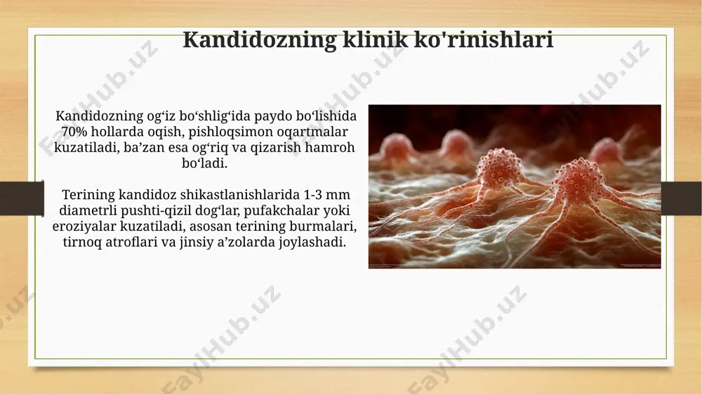 zamburugʻ infiksiyalari (kandidoz, aspergillez) - Page 5