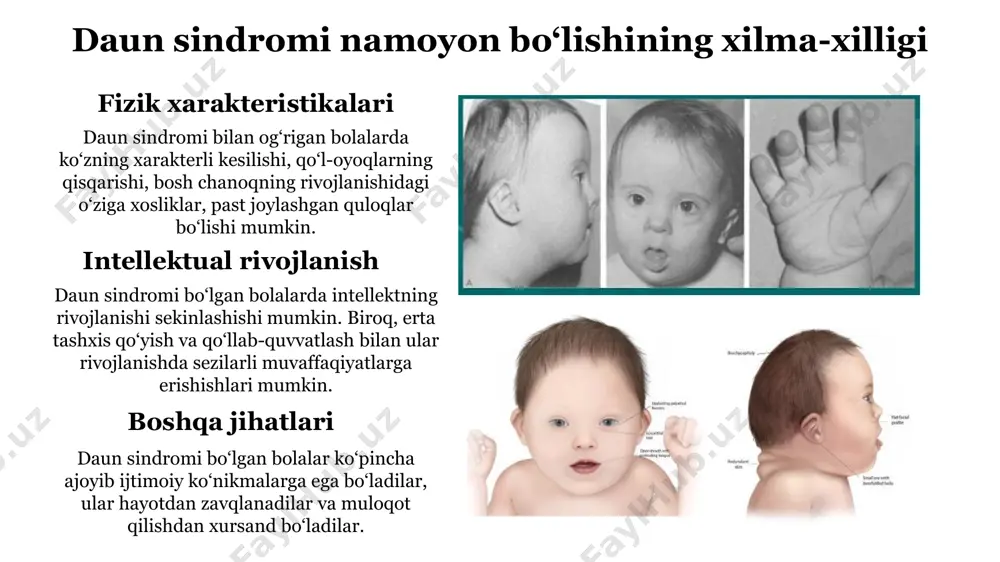 daun sindromi: tushunish va qo‘llab-quvvatlash - Page 3