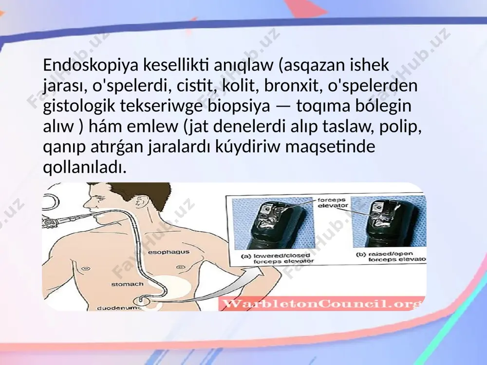 toliq ishki qaytiw. endoskoplar - Page 5
