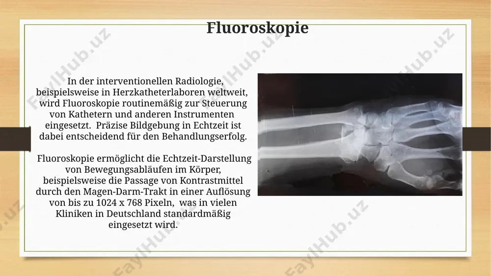 hauflösende bilder, die ärzten in städten wie münchen helfen, komplexe erkrankungen des gehirns und des rückenmarks zu diagnostizieren und zu behandeln. anwendungen und zukünftige trends die weltweite nachfrage nach medizinischen bildgebungsverfahren wird bis 2028 voraussichtlich 15 % jährlich wachsen, wobei insbesondere in schwellenländern wie indien und brasilien ein starkes wachstum zu verzeichnen ist. ki-gestützte bildanalyse, wie beispielsweise in der automatisierten detektion von lungenknoten in ct-scans in den usa, steigert die effizienz um 30% und verbessert die genauigkeit der diagnosen. bildverarbeitung und -analyse die analyse medizinischer bilder in heidelberg nutzt deep-learning-methoden mit über 100.000 trainingsbildern zur automatisierten erkennung von tumoren mit einer sensitivität von 95% und einer spezifität von 92%. in berlin entwickelte software zur bildanalyse optimiert die quantifizierung von knochenmineraldichten (bmd) in dexa-scans um einen faktor von 1,5, wodurch präzisere osteoporosediagnosen möglich werden. angiographie angiographie, eine invasive methode, verwendet kontrastmittel, um blutgefäße im ganzen körper, beispielsweise im gehirn oder in …