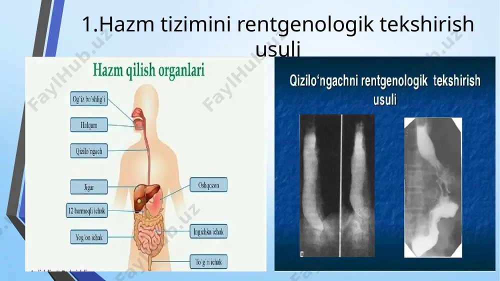 hazm tizimini instrumental tekshirish usullari - Page 4