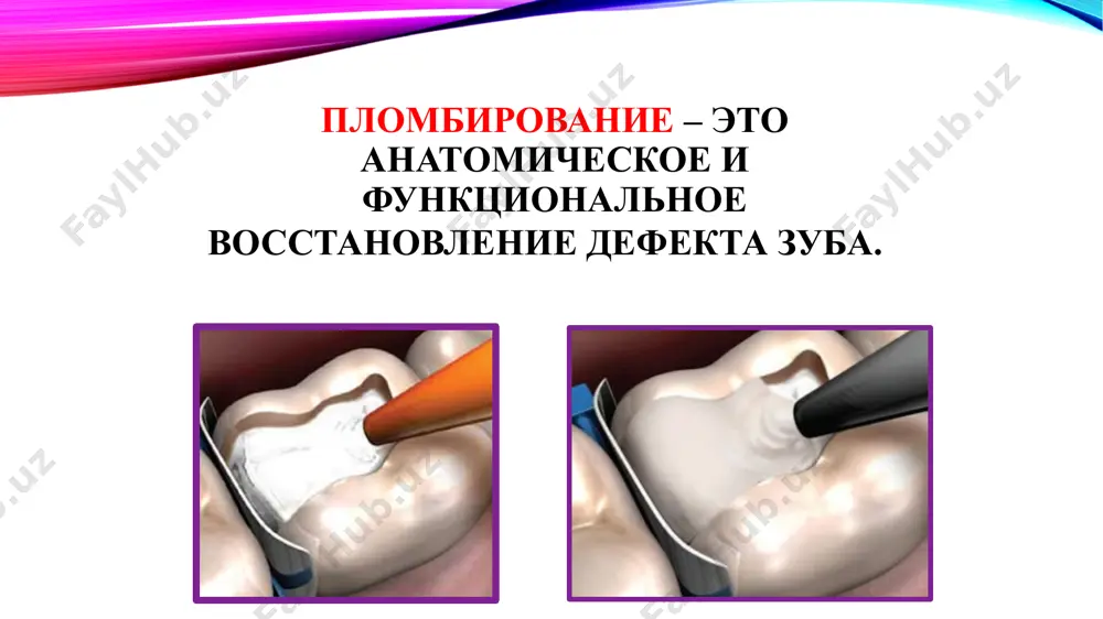 еленного времени): классификация современных пломбировочных материалов 1. цементы: 1.1. минеральные цементы а) цинк-фосфатные б) силикатные в) силикофосфатные 1.2. полимерные цементы: а) поликарбоксилатные б) стеклоиономерные 2. полимерные пломбировочные материалы: 2.1. ненаполненные: а) на основе акриловых смол б) на основе эпоксидных смол 2.2. наполненные (композитные) 3. компомеры - композиционно-иономерные системы 4. металлические пломбировочные материалы 4.1. амальгамы: а) серебряные б) медные 4.2. сплавы галлия 4.3. золото для прямого пломбирования б. непластичные (первично твердые) : 1. вкладки: а) металлические (литые) б) фарфоровые в) пластмассовые и композитные г) комбинированные (металл+фарфор) 2. виниры - адгезивные облицовки 3. штифты: а) парапульпарные штифты (пины) б) внутрипульпарные штифты (посты) (раздел "эндодонтия") iii. по способу отверждения материалы химического отверждения – материалы, переходящие из пластичного в твердое состояние за счет происхождения в них химической реакции между двумя химическими компонентами после их смешивания (амальгама, минеральные и полимерные цементы, композиты химического отверждения). светоотверждаемые материалы – полимеризация этих материалов происходит за счет химической реакции, …
