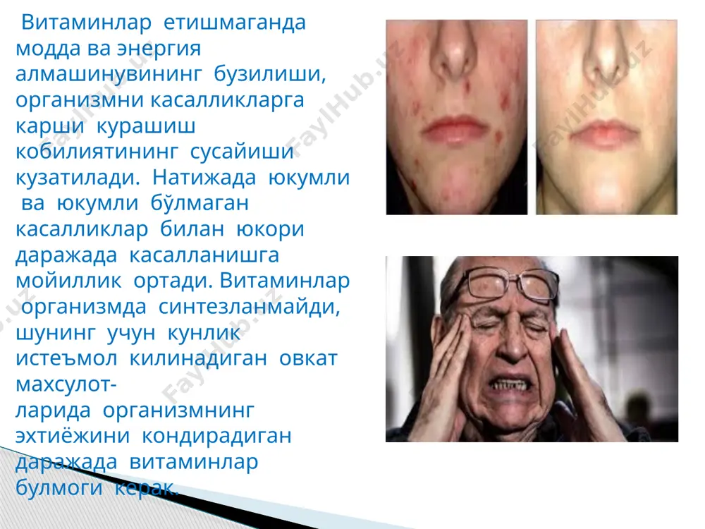барча турдаги моддалар алмашинувида чукур узгариш­лар руй беради. витамин в3 (пантотенат кислота). у одам ва сут эмизувчи хайвонларда ичак микрофлораси томонидан синтезланади. пантотенат кислотанинг энг куп микдори бугдой куртаги ва кепагида булади. одам органпзмига овкат таркибида эркин хамда унинг турли хосилалари холида тушиб, ичакда гидролизланиб понтотенат холида с^рилади.пантотенат кислота организмда модда ва энергия алмашинувига сезиларли таъсир килгани холда иммунитет омилларини етарли даражада муътадил сакланиб туриши учун хам зарурдйр. витамин в6(пиридоксин). витамин в6ингичка ичакдан конга тез сурилади ва тукималарда пиридоксал-фосфатга айланади. пиридоксал-фосфат нуклеин кислоталар, оксил, ёг, углевод алмашинувида энергия хосил булиши жараёнларини тезлатувчи ферментлар тизими таркибига киради. пиридоксал-фосфат куп микдорда жигарда, камрок буйракларда, мушакларда, оищозон ости безида, юрак тукималарида, ингичка ичак шиллик, каватида, талокда ва упкада булади. витамин в6 табиатда кенг таркалган. пивонинг курук ачиткилари, балик, бошок.лилар дони ва кепаги витамин в6 га энг бой хисобланади. сабзавот ва сут махсулотларида унинг микдори оз. кам микдорда витамин в6 ичак микрофлораси томонидан синтезланади. …